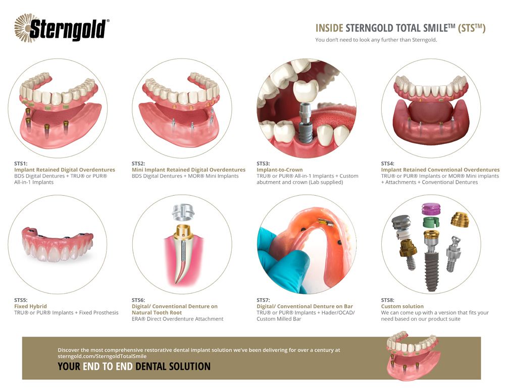Sterngold Dental has announced its Sterngold Total Smile™ (STS).