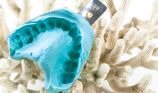 How Impression Materials Have Changed Over Time Dental Products Report