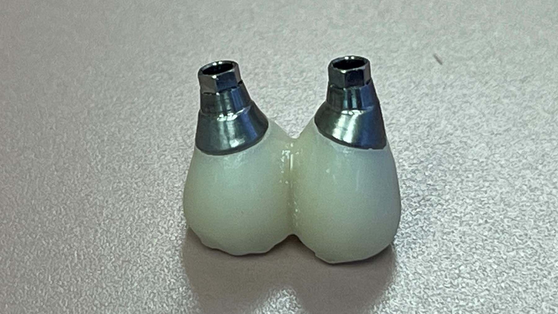 Figure 6. Buccal view of the printed crowns without support.