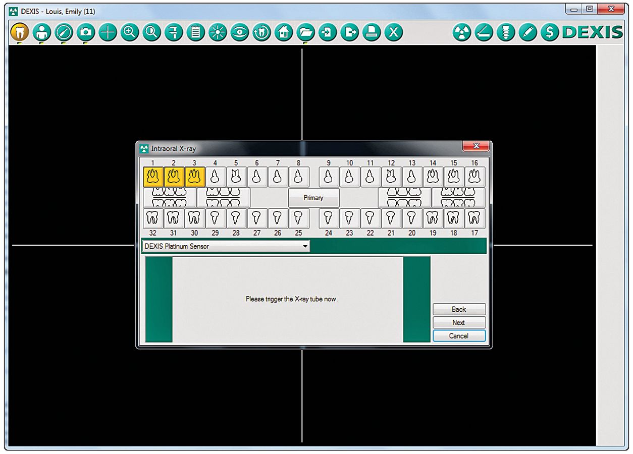 dexis platinum software dexis platinum software