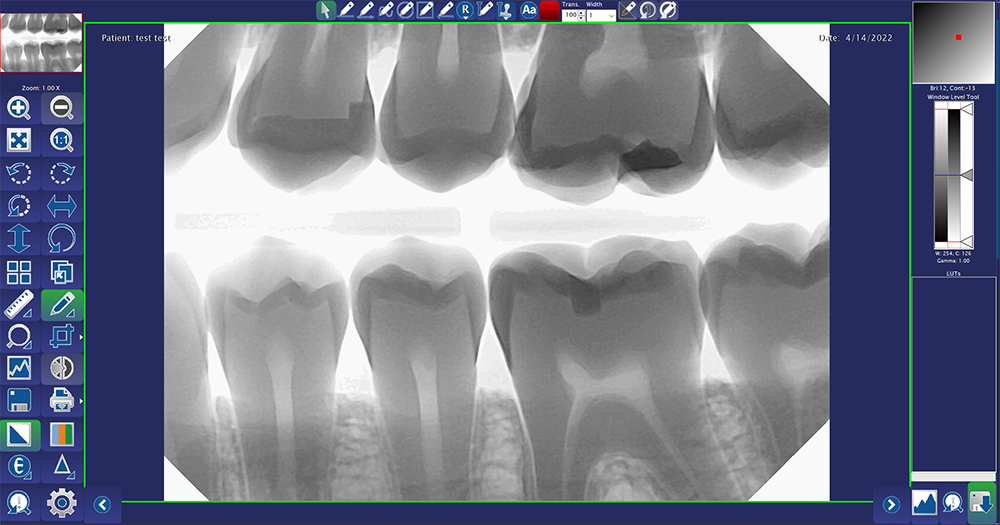 Adjusting the contrast of a dental x-ray