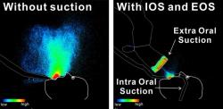Researchers in Japan Use LED Imaging to Show Oral Suction Devices’ Impact on Aerosol Reduction