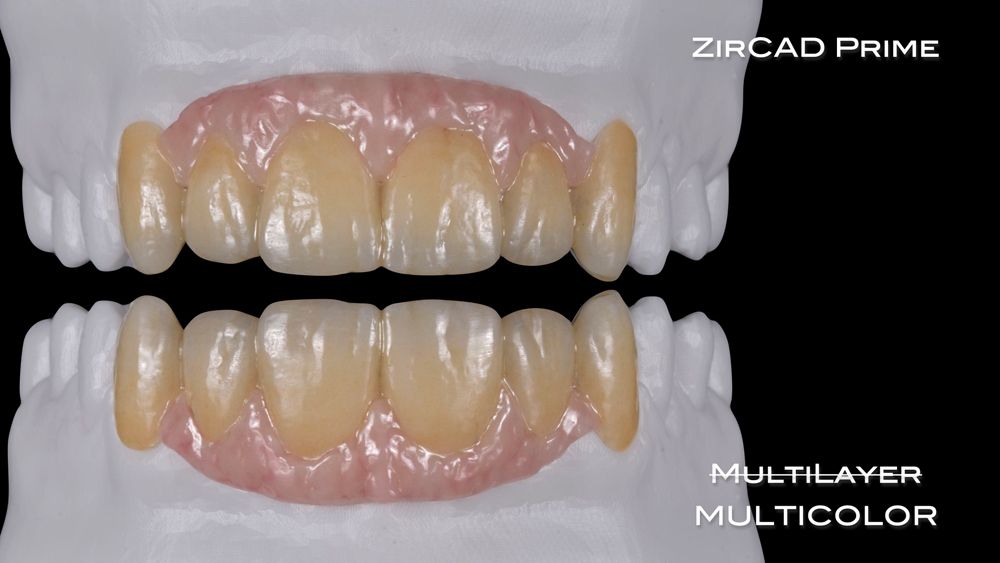 The Value of ZrO2 Today: Material Composition and Light Performance