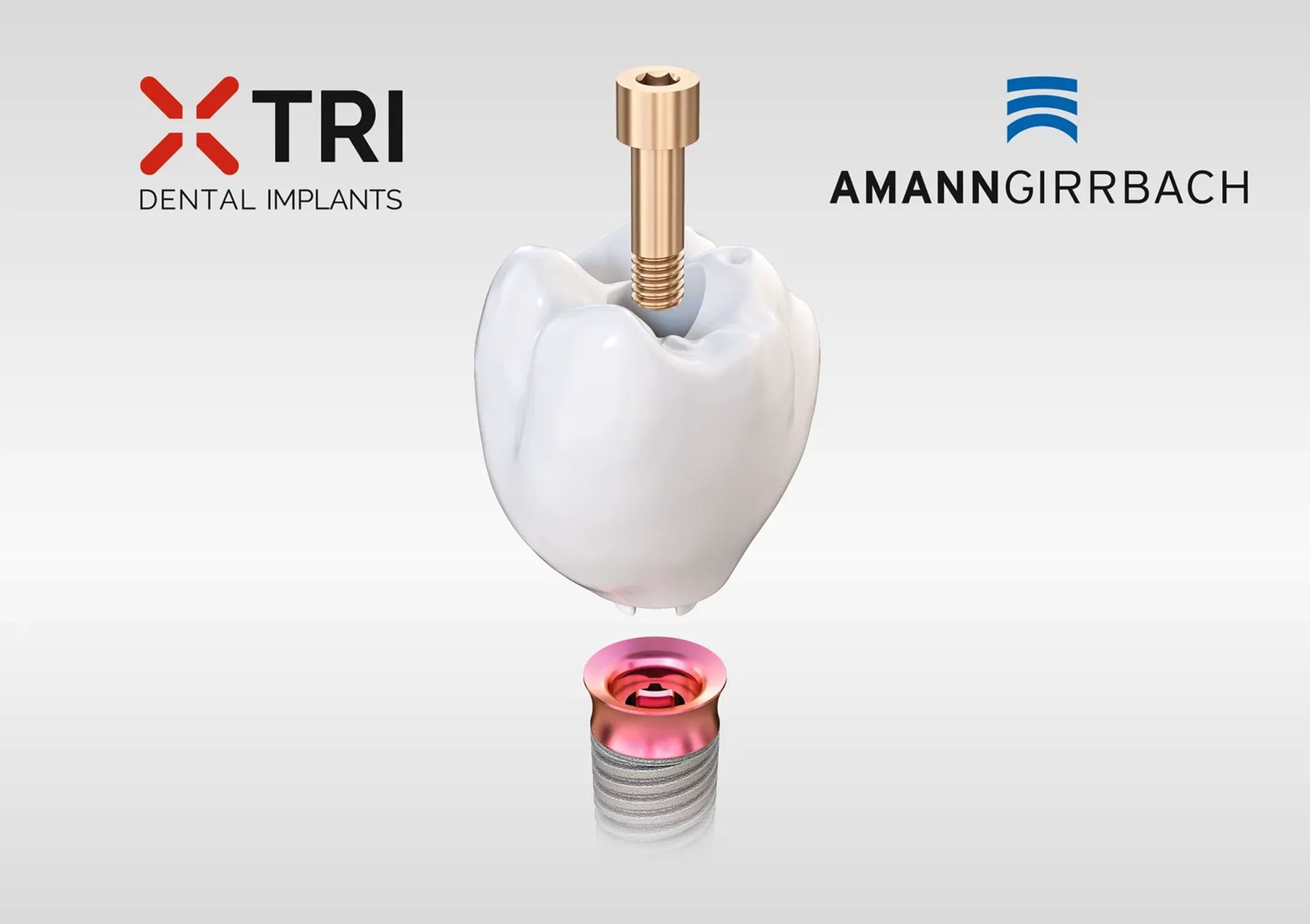 Amann Girrbach, TRI Dental Implants Partner for New Digital Matrix Implant