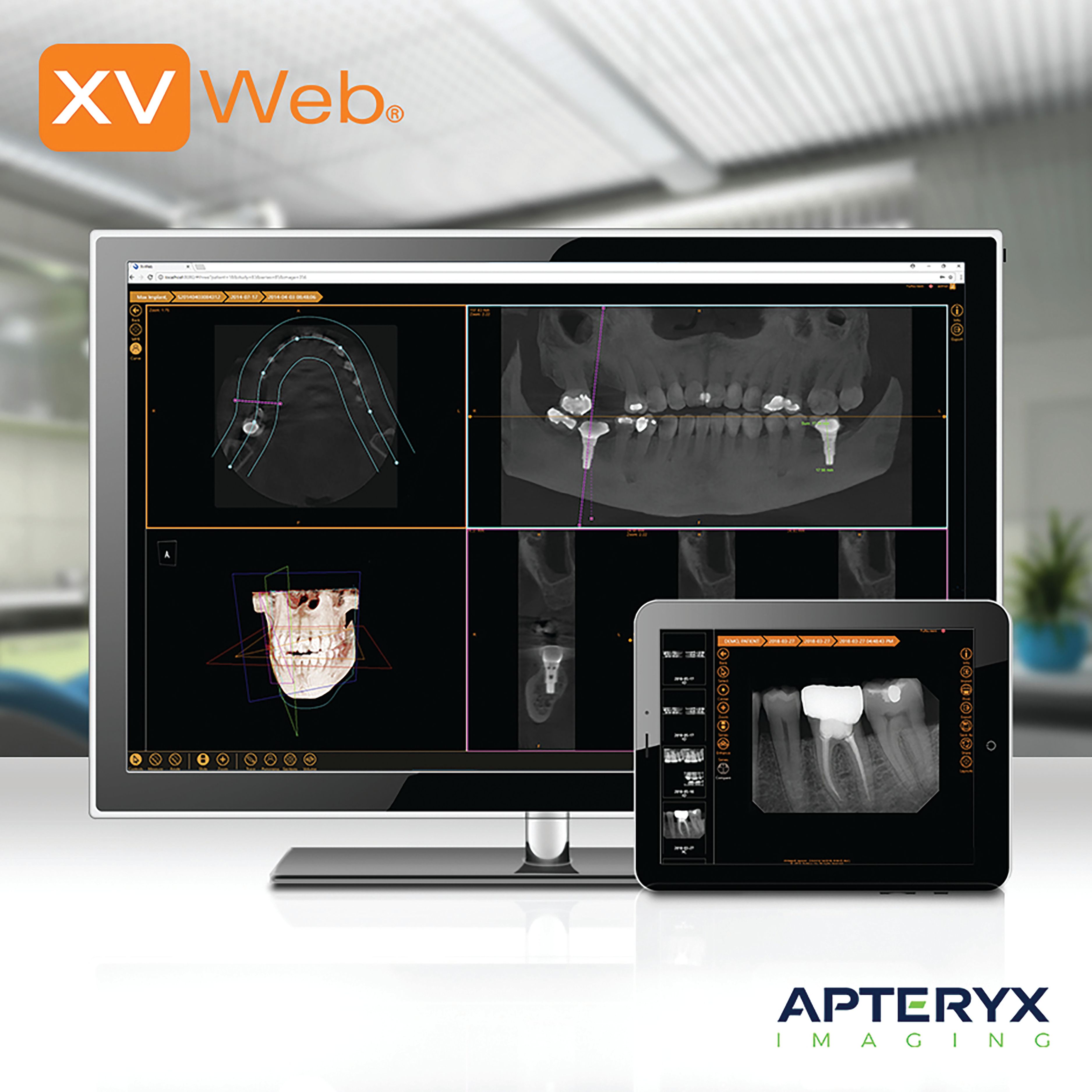 XVWeb