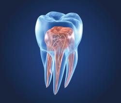 Mapping the Root: The Latest in Endodontic Diagnostic and Treatment Planning Technology