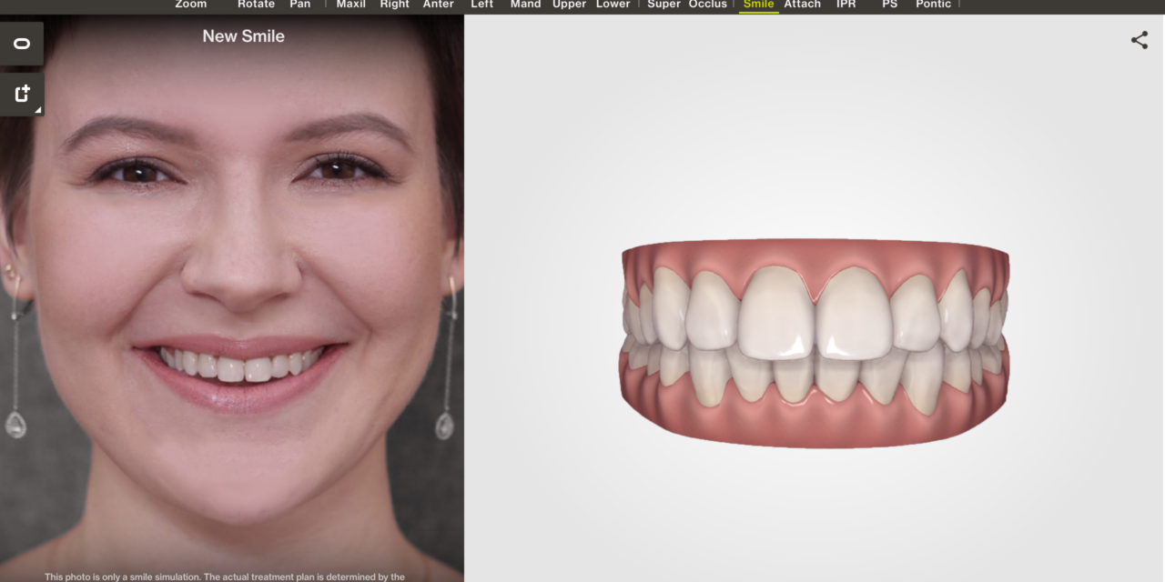 ClinCheck Treatment Planning Software from Align Technology Inc