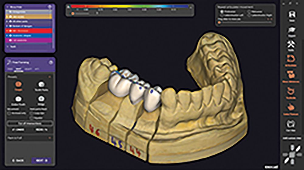 DentalCAD 3.0 Galway