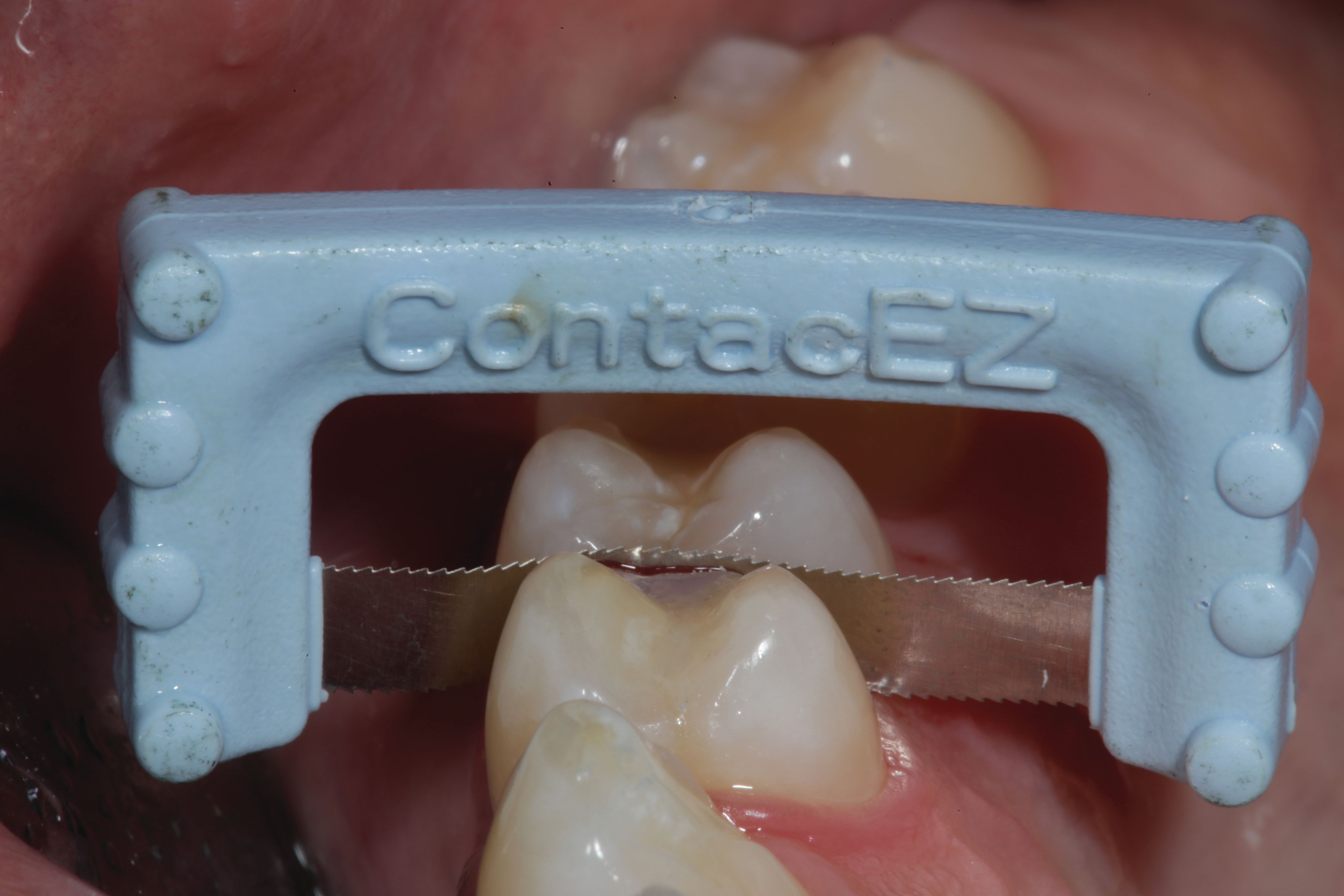 Figure 17