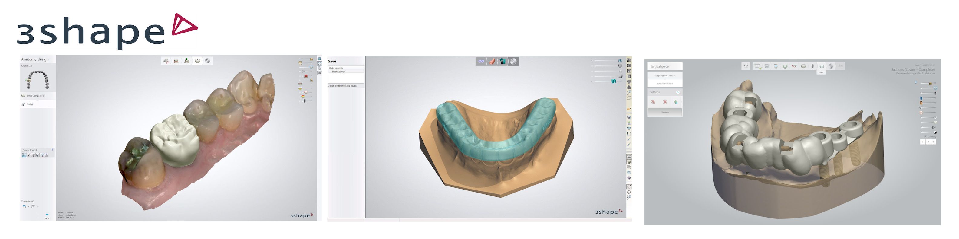 3Shape’s Dental System™ 2014 includes a new user interface, optimized ...