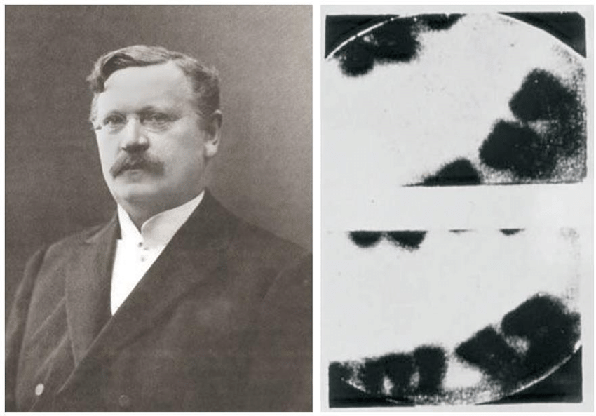Otto Walkhoff and first dental radiographs