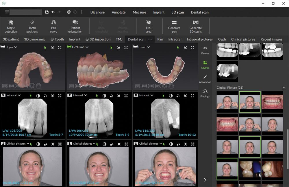 Figure 2 The ability to simultaneously view and interact with patient images and radiographs from multiple sources within a single screen can enhance diagnostics, treatment planning, and case presentation. 