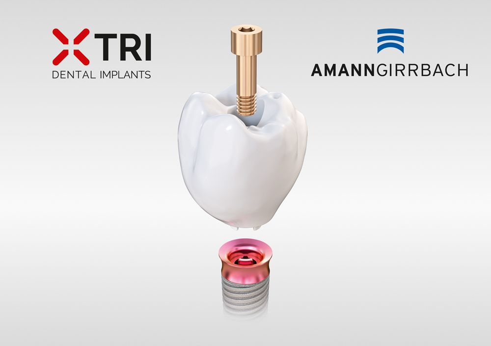 The matrix® implant is designed for new digital manufacturing technologies such as CAD/CAM milling or 3D printing.