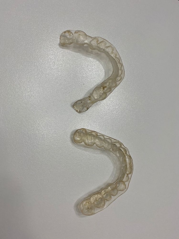  PT’s Clear Aligners (Figure 1)