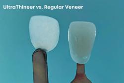 BMF Gets FDA Clearance for UltraThineer Veneer Material