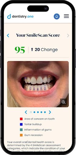 Dentistry.One Launches SmileScan Artificial Intelligence Smartphone Tool