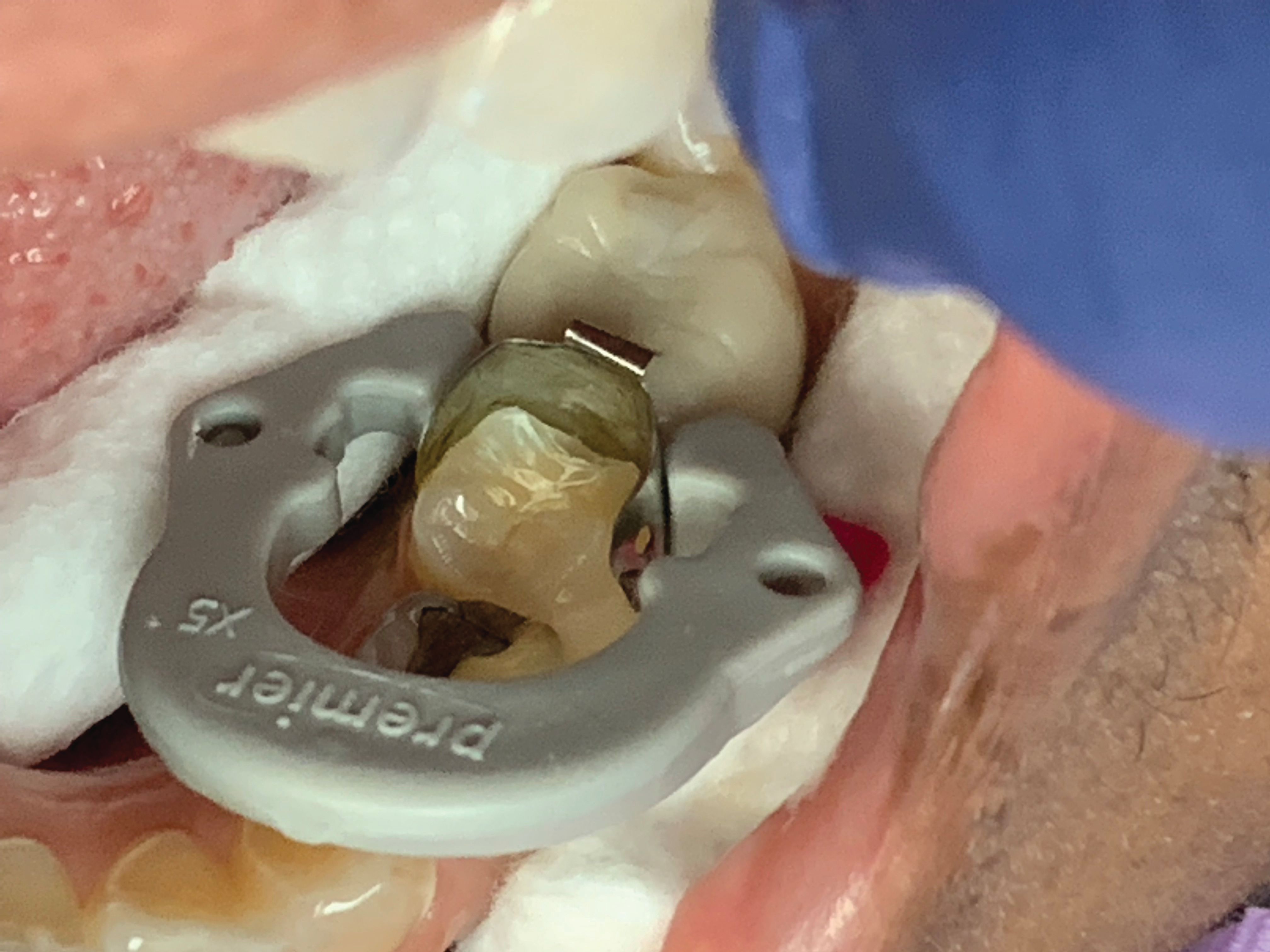 Matrix System Dental Ppt at Caitlyn Lavater blog