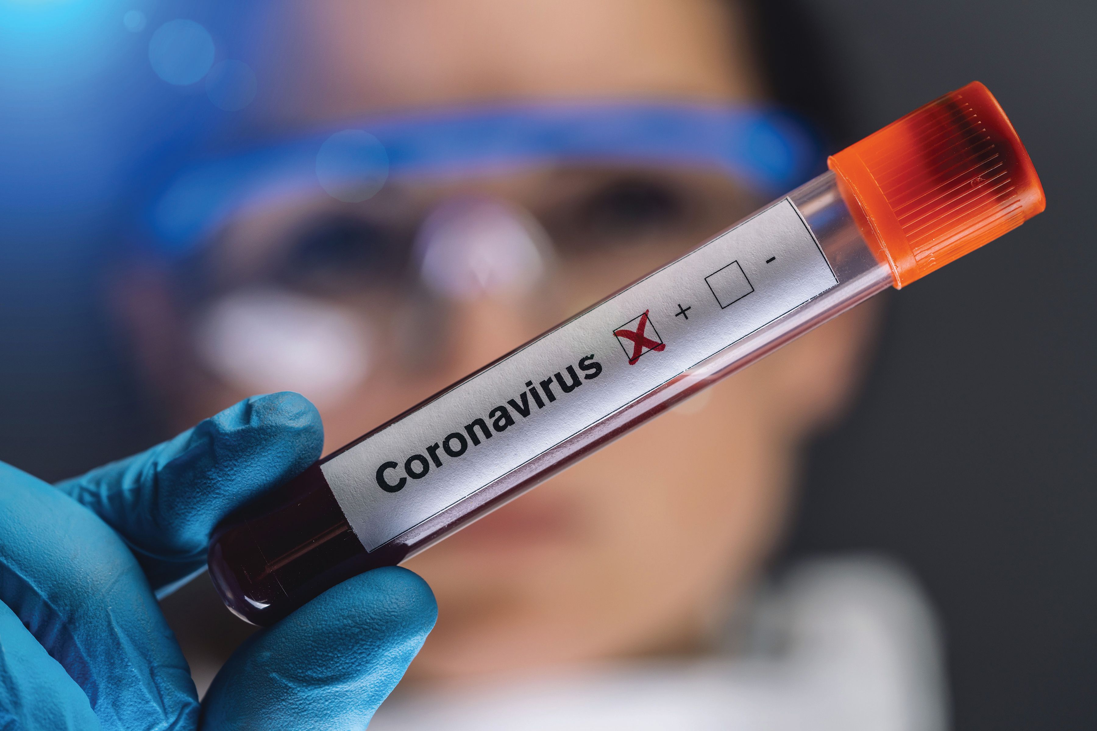 The Risky Business of Clinical Dental Hygiene: What to Do If You Test Positive for COVID