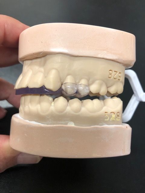 Urbanek TMJ Device