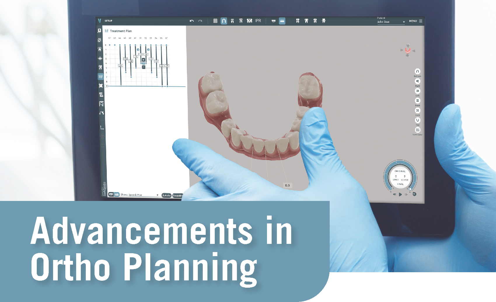 eBook: Advancements in Ortho Planning
