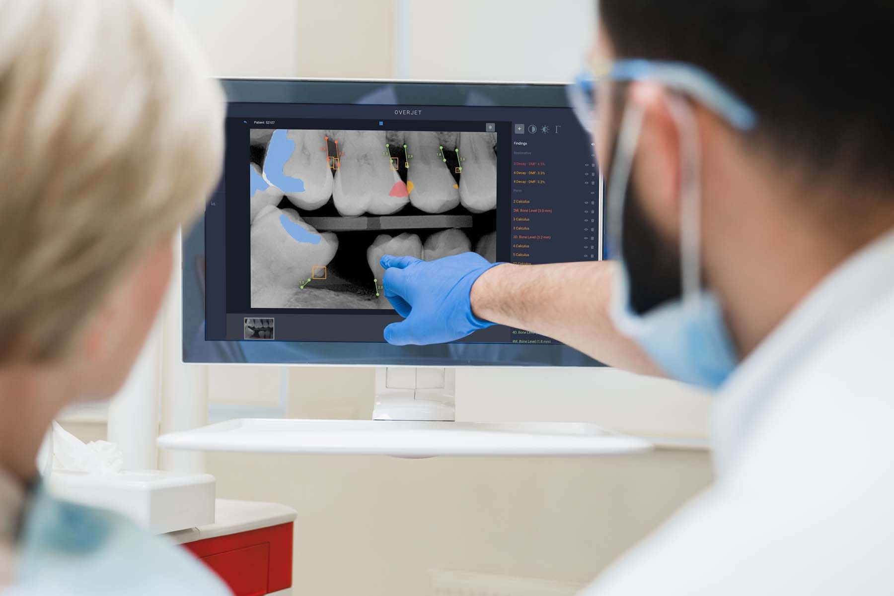 A Revolution in How Dentists Diagnose Disease and Present Treatment |  Image Credit: © Overjet