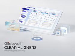  Glidewell, ProMonitoring Partner to Launch Glidewell Clear Aligners: Powered by ProMonitoring
