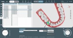 SoftSmile Secures FDA Clearance for Artificial Intelligence Powered Software VISION
