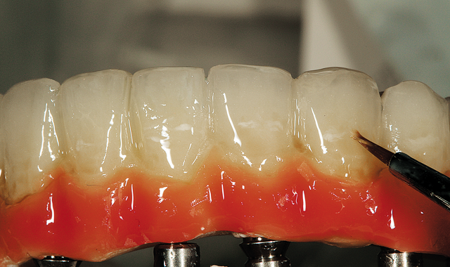 Step 10 With an A1 base application, he was able to maximize the natural-looking effect all dental technicians hope to achieve in their restorations. 