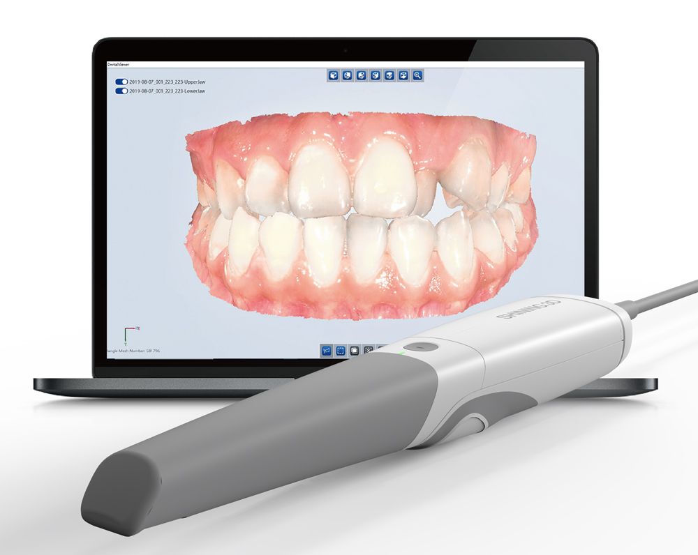 Aoralscan 3 intraoral scanner