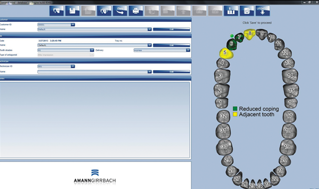 Step 1 Using the data from Amann Girrbach MAP 400 scanner