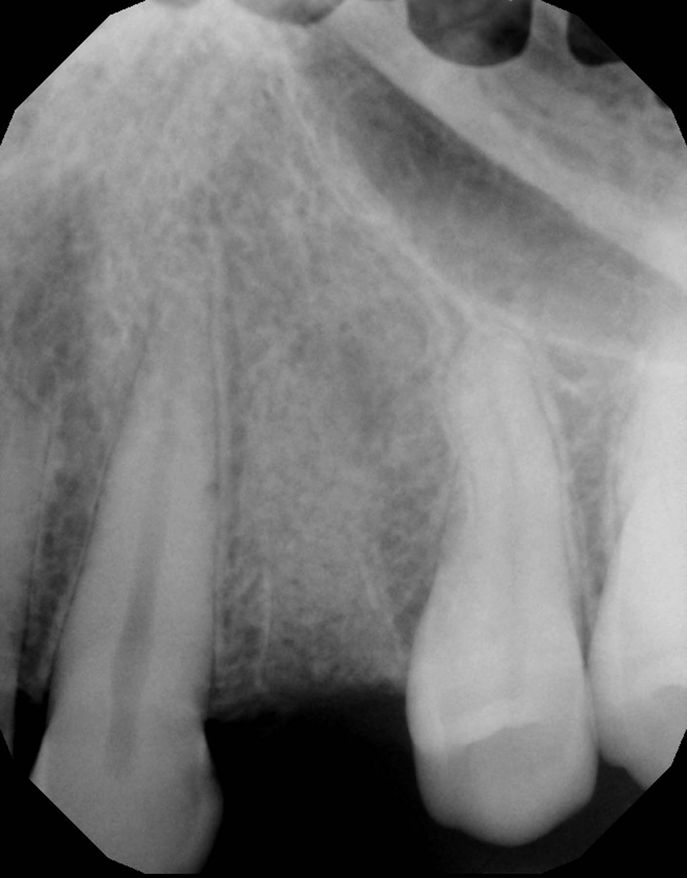 Figures 8-9. Postoperative  images from case 1.