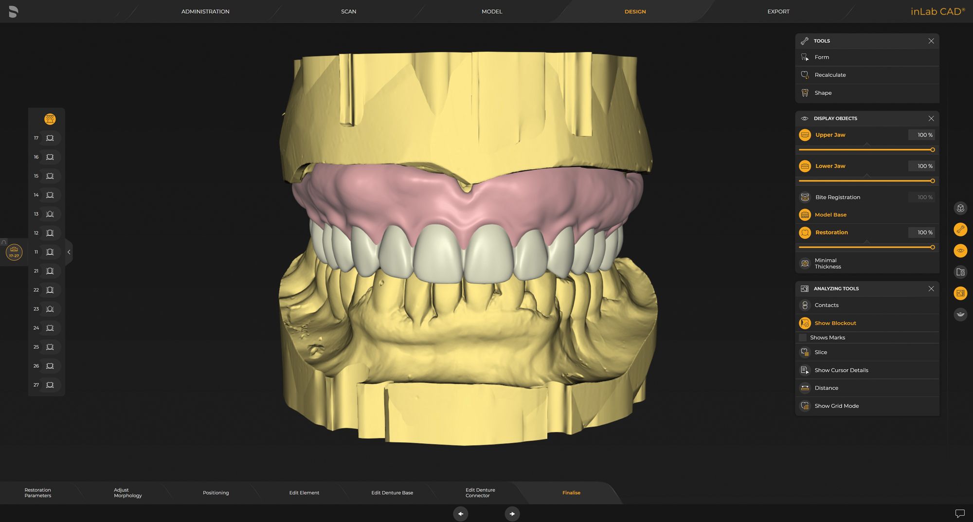 CAD/CAM Software   inLab Software 22.0