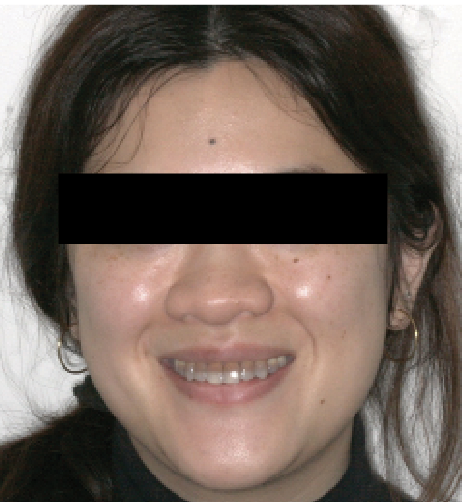 Figure 1. Preoperative 1:10 image of full face.