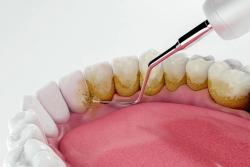 Pioneering a New Era in Periodontal Care: Embracing Advanced Techniques and Interdisciplinary Collaborative Strategies