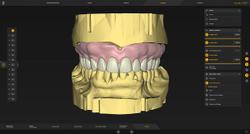 Dentsply Sirona’s New inLab Software 22.0 Integrates CEREC Primemill Into Streamlined Workflows