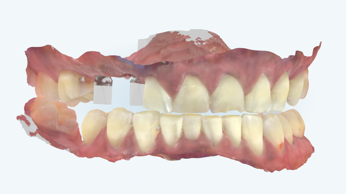 Figure 3. The Deprogramer platform demonstrates a repeatable stop. 