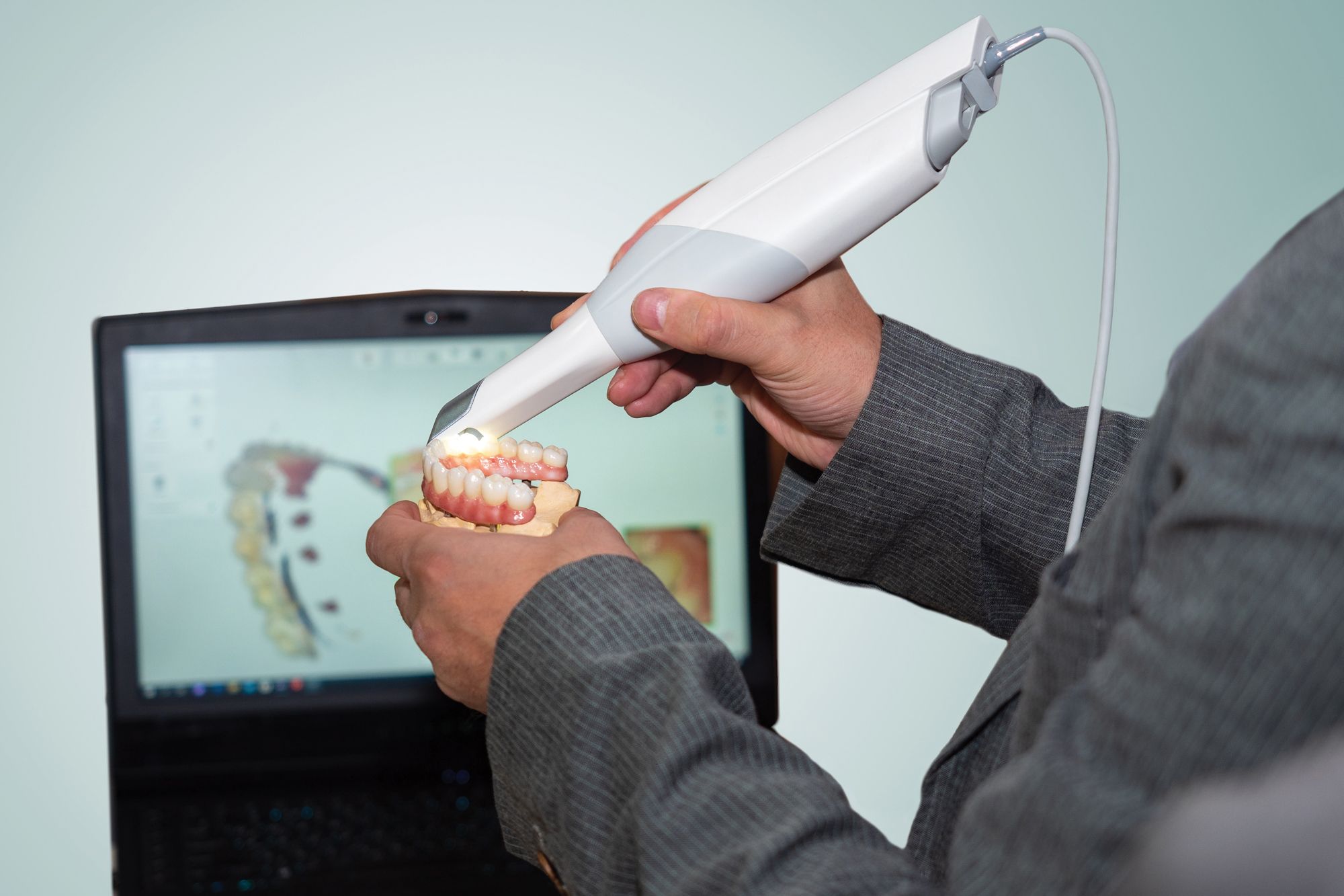 The Best Intraoral Accuracy: Intraoral Scanner Product Roundup. Photo courtesy of Grispb/stock.adobe.com.