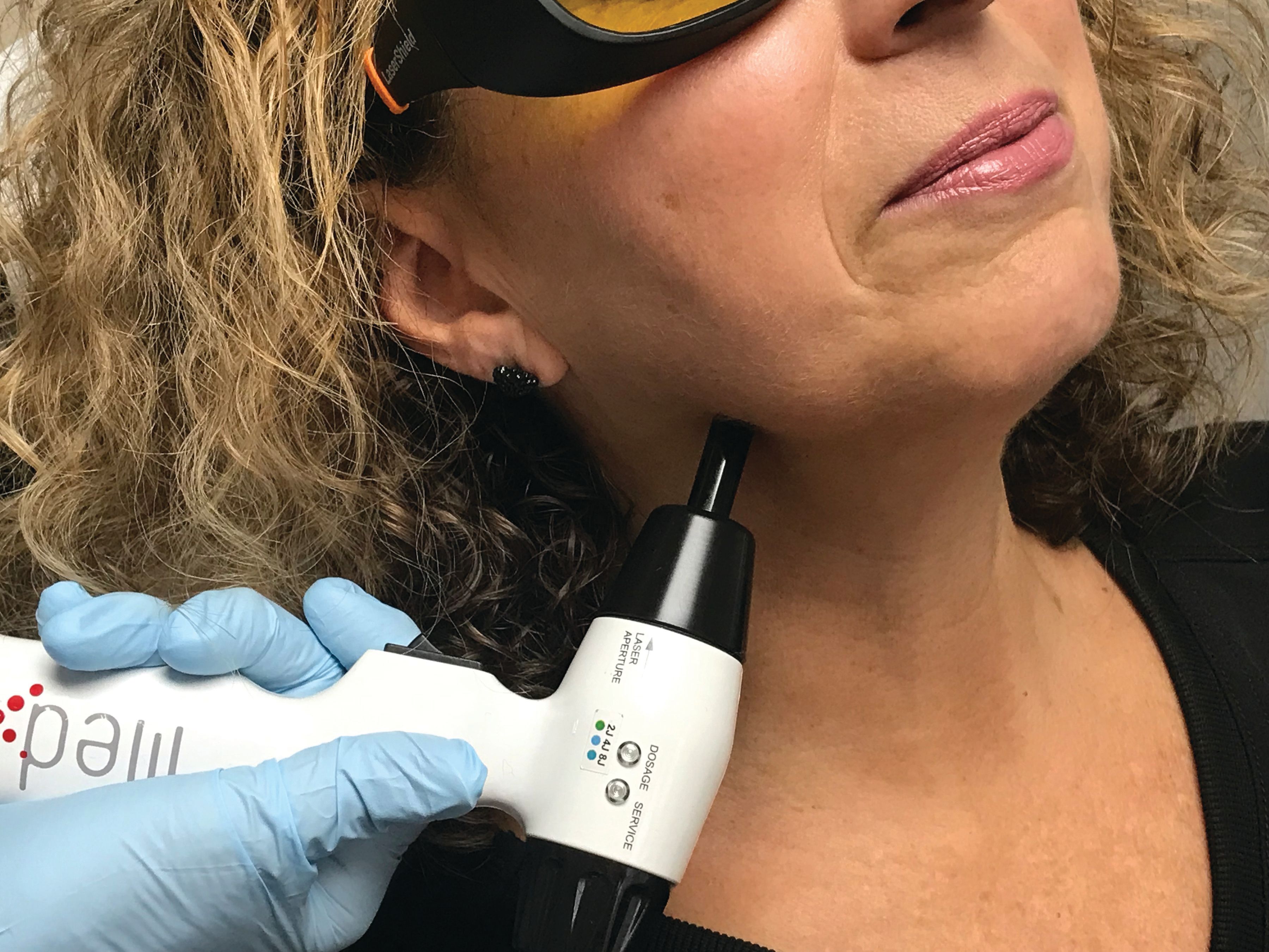  How to Treat Facial Pain With Photobiomodulation/Low-Level Laser Therapy