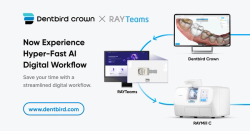 Dentbird Crown and RAYTeams Now Integrated to Enhance Digital Dentistry