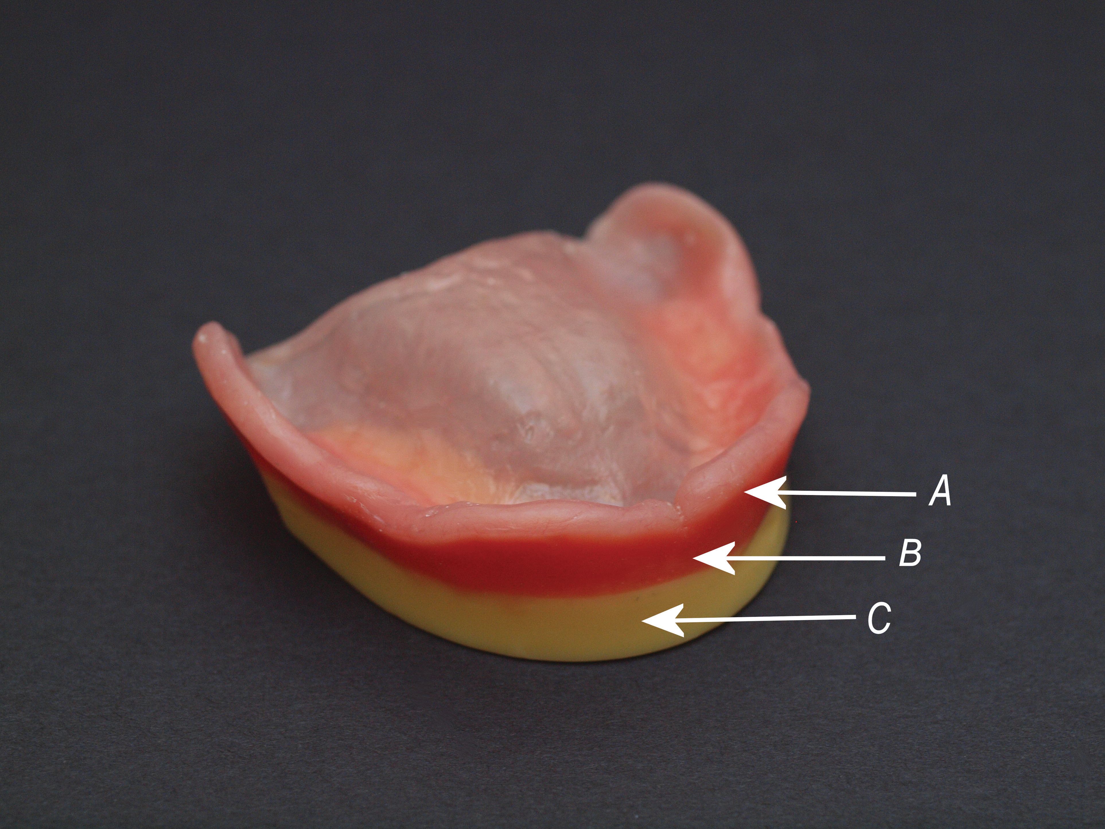 How to Achieve the Completed Denture Base