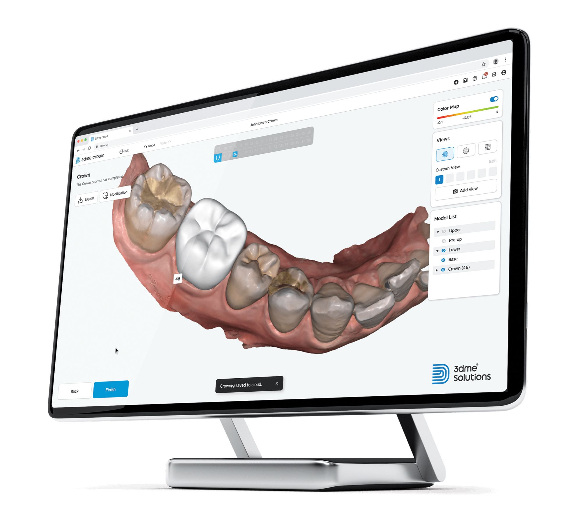 CAD Crown Software 3Dme Crown