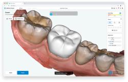 New AI-Based Web Dental CAD Designed to Offer One-Click Crown Design