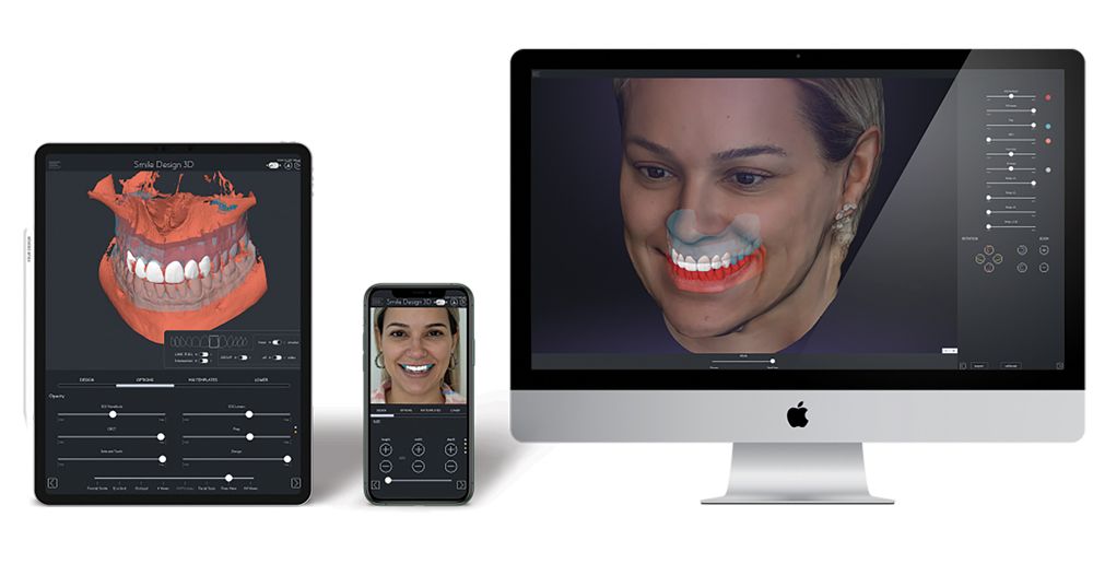 3D Smile Design