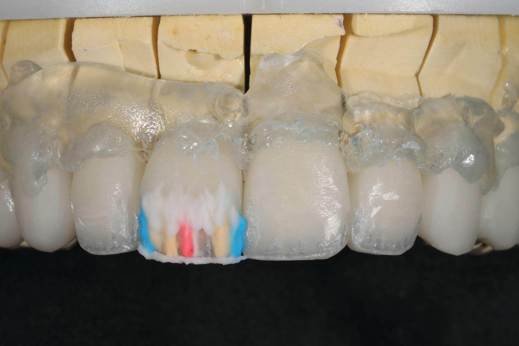 Figure 16. Layered effects over stain. 