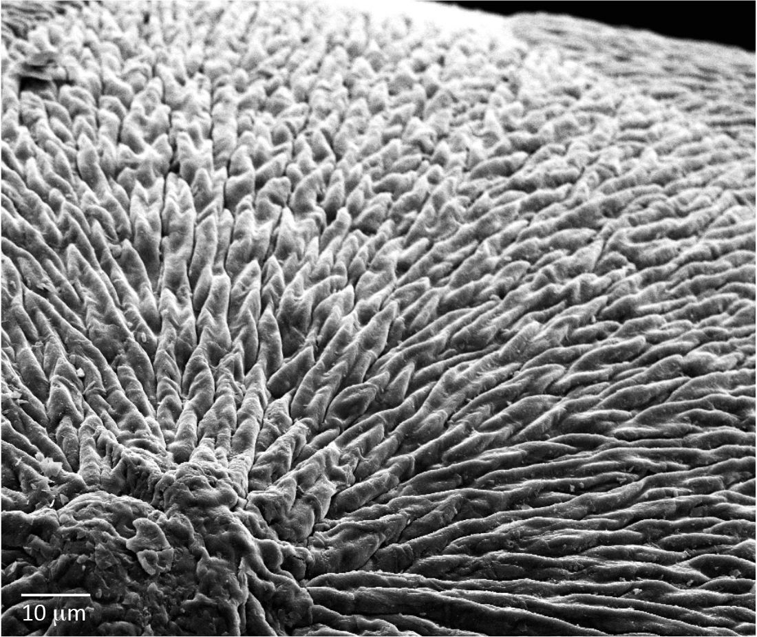 Enamel Modification New Tech Might Replace Established Treatment Options for Enamel Loss