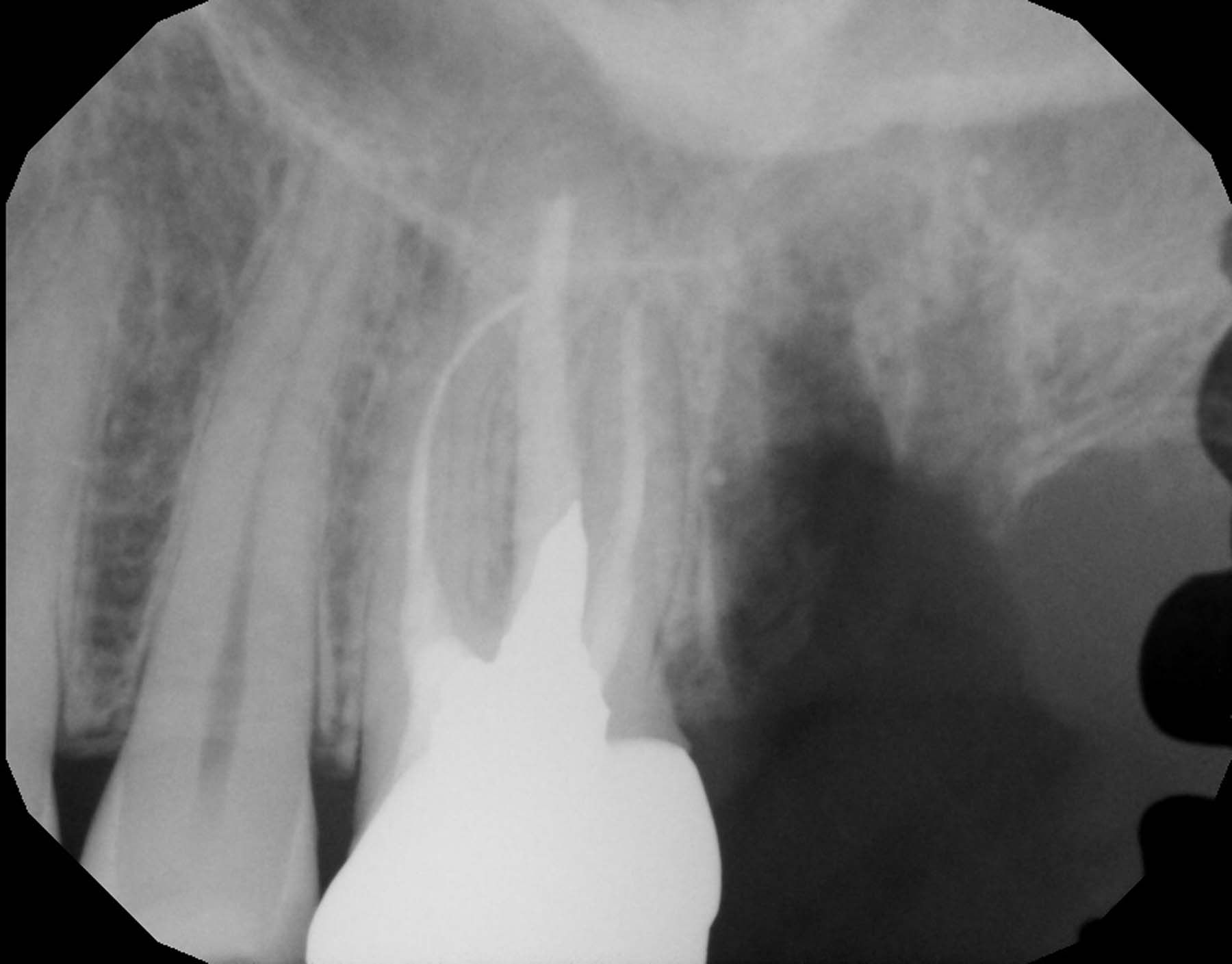 Figures 15-16. Postoperative images for case 2.