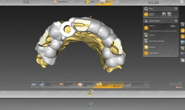 Technique: An Integrated Surgical Guide Workflow