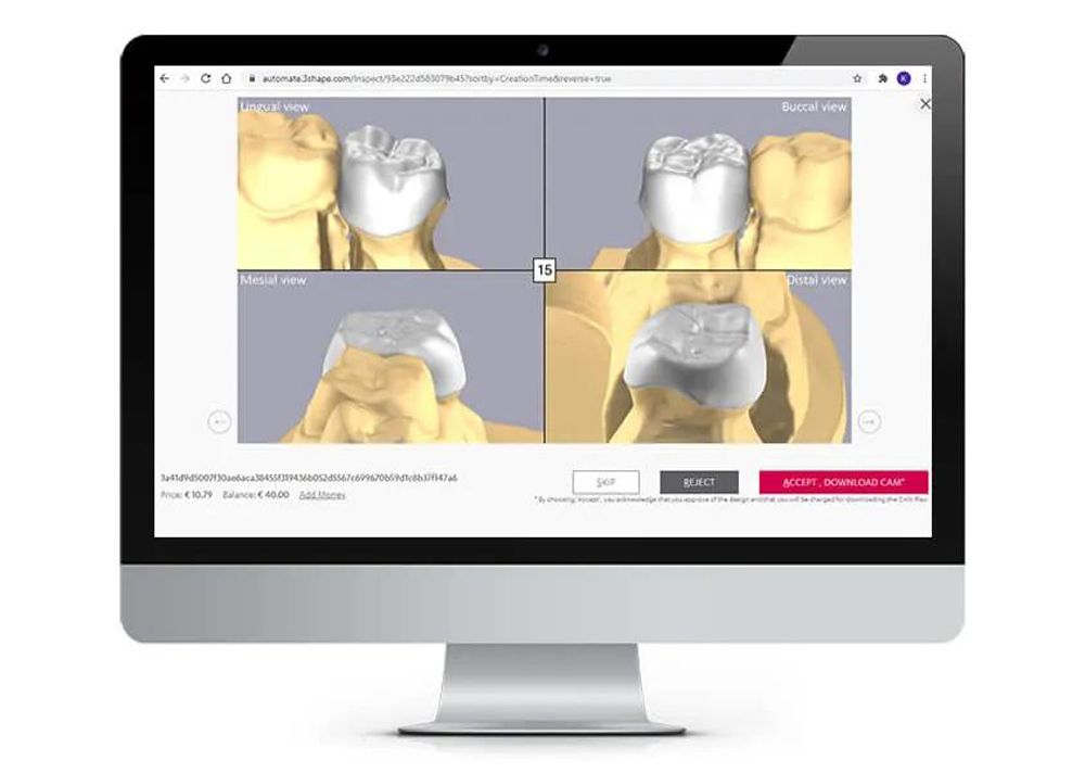 3Shape Automate