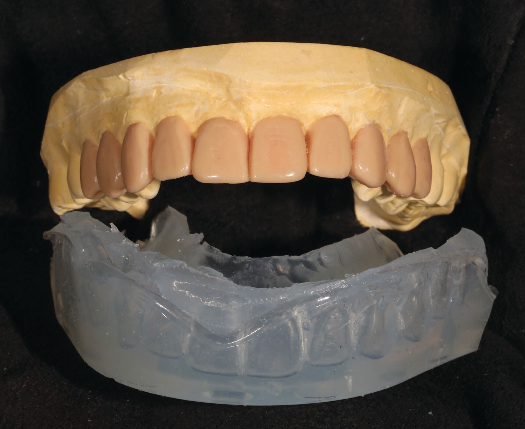 Figure 11. Wax-up arch form.