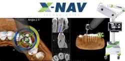 X-Nav Technologies Receives FDA Clearance for Endodontic Procedures 
